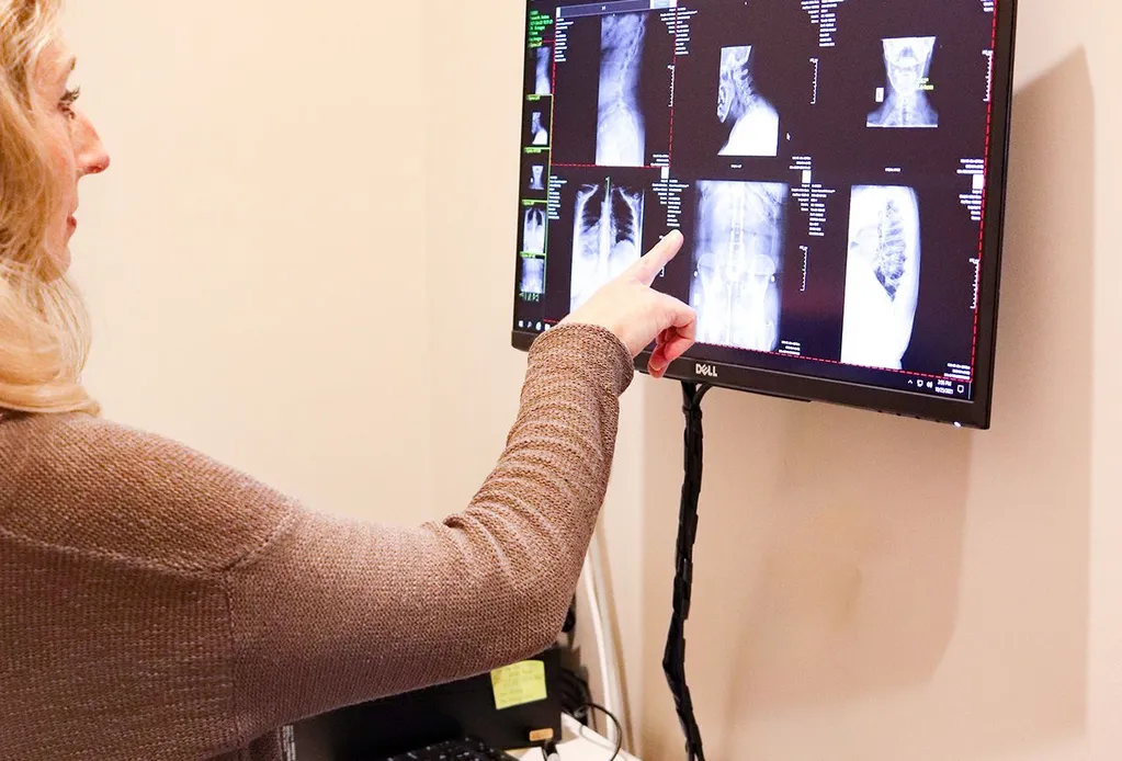 Digital X-ray review for personalised chiropractic care.