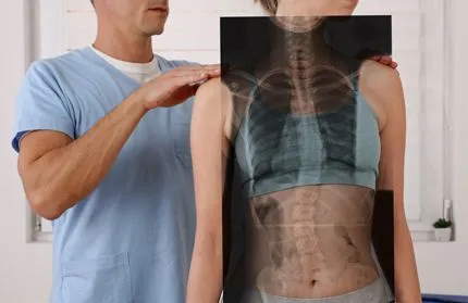 Spinal alignment check using diagnostic imaging
