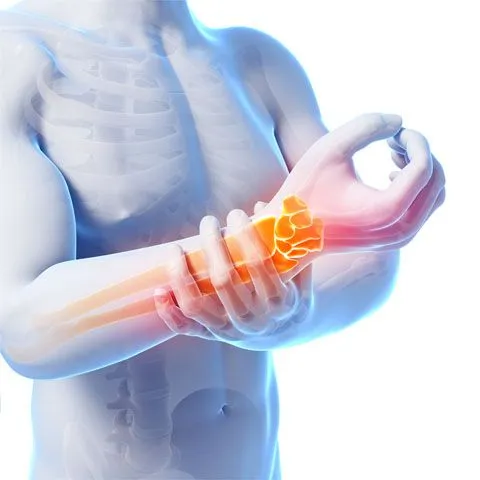 Hand and elbow pain related to joint strain.