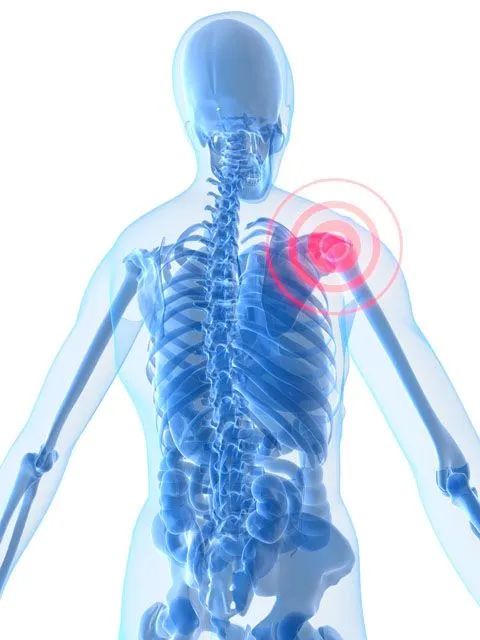 Shoulder pain affecting upper body movement.